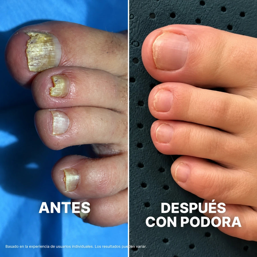 Usé sandalias en las vacaciones por primera vez en 4 años
