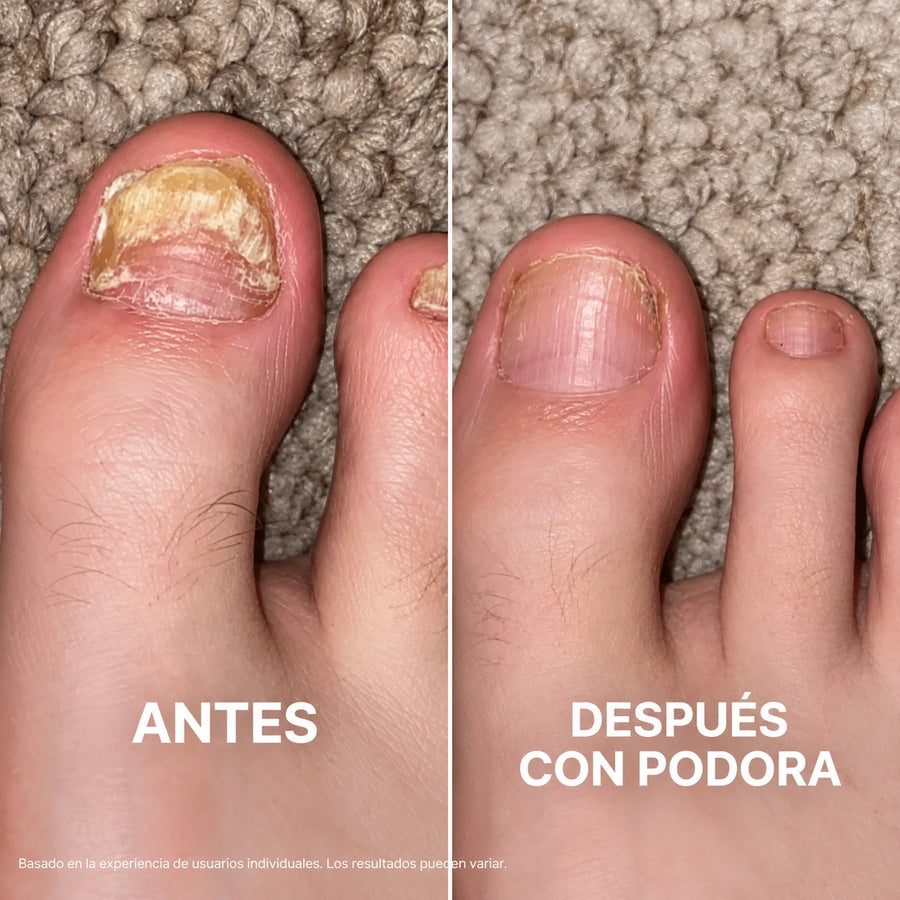 Gasté cientos en lacas de farmacia. Cada una de ellas solo se quedaba en la superficie.